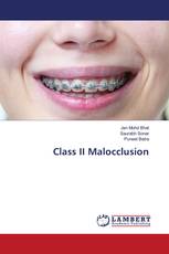 Class II Malocclusion