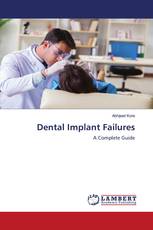 Dental Implant Failures