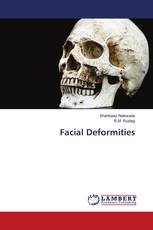 Facial Deformities