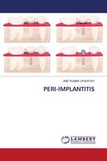 PERI-IMPLANTITIS
