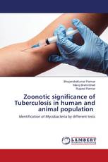 Zoonotic significance of Tuberculosis in human and animal population