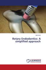 Rotary Endodontics: A simplified approach