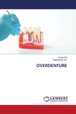 OVERDENTURE