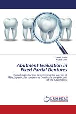 Abutment Evaluation in Fixed Partial Dentures