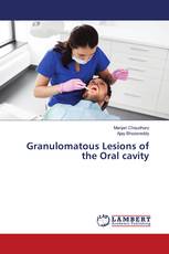 Granulomatous Lesions of the Oral cavity