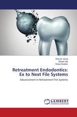 Retreatment Endodontics: Ex to Next File Systems