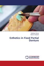 Esthetics in Fixed Partial Denture