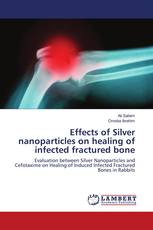 Effects of Silver nanoparticles on healing of infected fractured bone