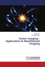 Fusion Imaging - Application In Maxillofacial Imaging