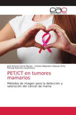 PET/CT en tumores mamarios