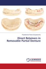 Direct Retainers in Removable Partial Denture
