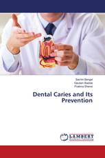 Dental Caries and Its Prevention