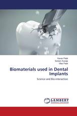 Biomaterials used in Dental Implants