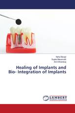 Healing of Implants and Bio- Integration of Implants