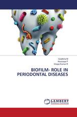 BIOFILM- ROLE IN PERIODONTAL DISEASES