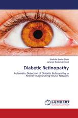 Diabetic Retinopathy