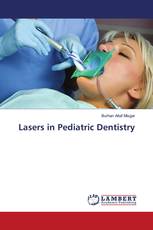 Lasers in Pediatric Dentistry