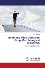 MR Image Edge Detection Using Morphological Algorithm