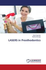 LASERS in Prosthodontics
