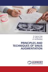 PRINCIPLES AND TECHNIQUES OF SINUS AUGMENTATION