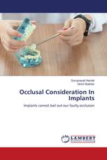 Occlusal Consideration In Implants