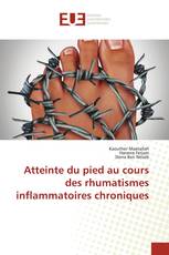 Atteinte du pied au cours des rhumatismes inflammatoires chroniques