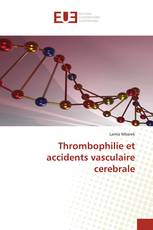 Thrombophilie et accidents vasculaire cerebrale