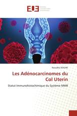 Les Adénocarcinomes du Col Uterin