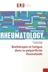 Biothérapie et fatigue dans la polyarthrite rhumatoïde