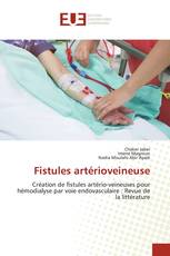 Fistules artérioveineuse