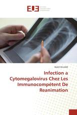 Infection a Cytomegalovirus Chez Les Immunocompétent De Reanimation