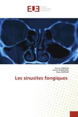 Les sinusites fongiques