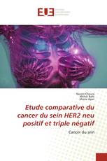 Etude comparative du cancer du sein HER2 neu positif et triple négatif