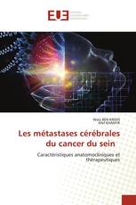 Les métastases cérébrales du cancer du sein