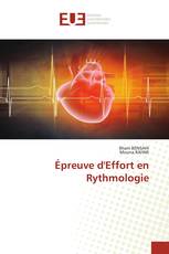 Épreuve d'Effort en Rythmologie