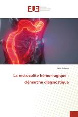 La rectocolite hémorragique : démarche diagnostique
