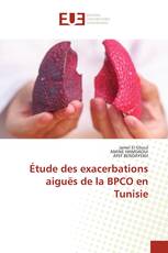 Étude des exacerbations aiguës de la BPCO en Tunisie