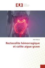 Rectocolite hémorragique et colite aigue grave