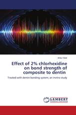 Effect of 2% chlorhexidine on bond strength of composite to dentin