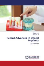 Recent Advances In Dental Implants