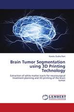 Brain Tumor Segmentation using 3D Printing Technology