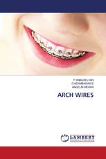 ARCH WIRES