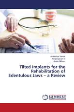 Tilted Implants for the Rehabilitation of Edentulous Jaws – a Review