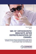 SBS OF ORTHODONTIC BRACKETS AFTER DEPROTEINIZATION OF ENAMEL