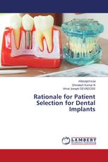 Rationale for Patient Selection for Dental Implants