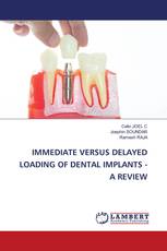IMMEDIATE VERSUS DELAYED LOADING OF DENTAL IMPLANTS - A REVIEW
