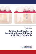 Cortico-Basal Implants: Managing Atrophic Ridges with Fixed Prosthesis