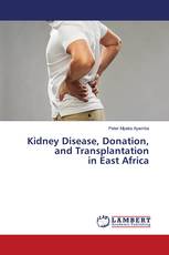 Kidney Disease, Donation, and Transplantation in East Africa