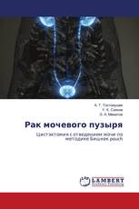 Рак мочевого пузыря