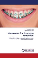 Miniscrews for En-masse retraction